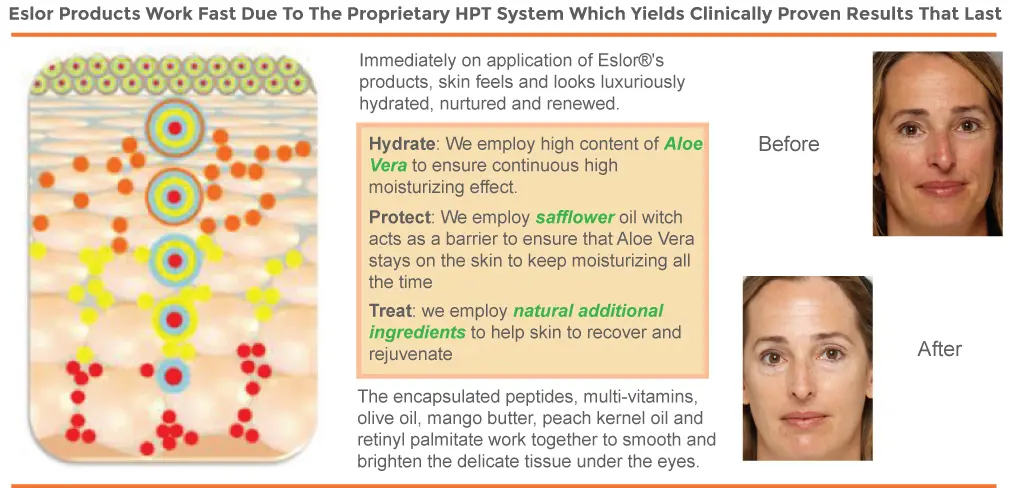 Eslor products work fast